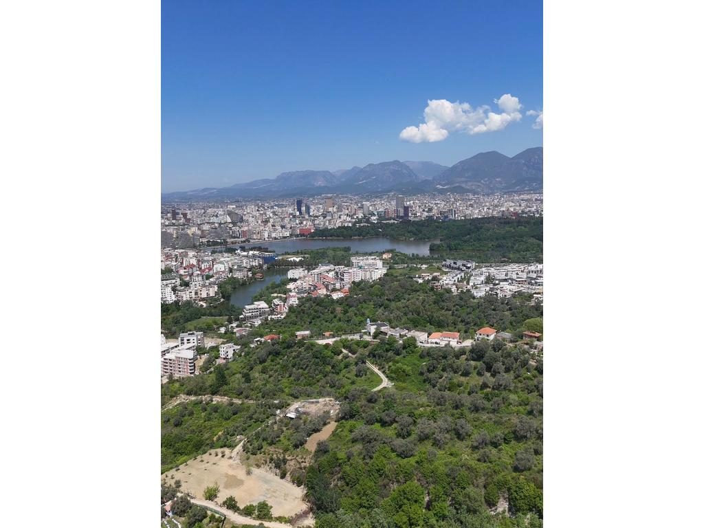 SHESIM, 1500 m² TOKE ME LEJE ZHVILLIMI!
